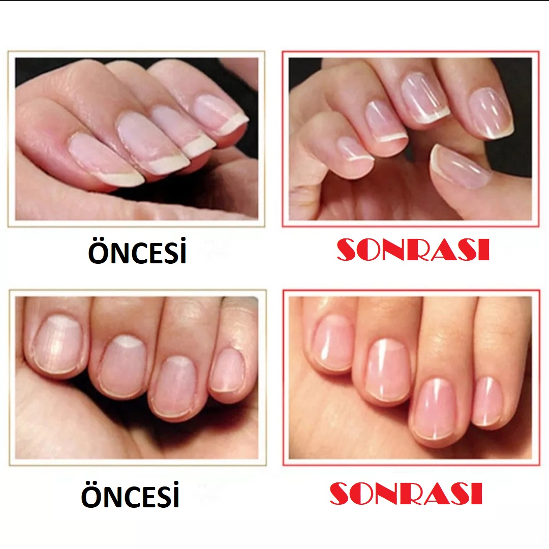 Cam Tırnak Törpüsü Mucizevi Tırnak Parlatıcısı